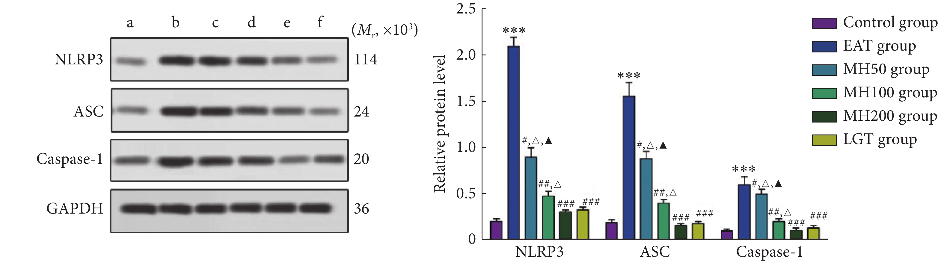 桑色素调节nlrp3/caspase-1通路改善大鼠实验性自身免疫性甲状腺炎的