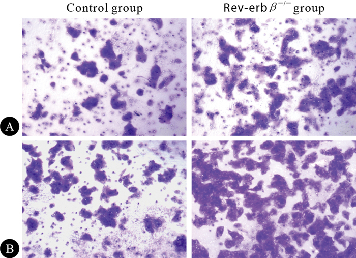 图                     transwell实验检测不