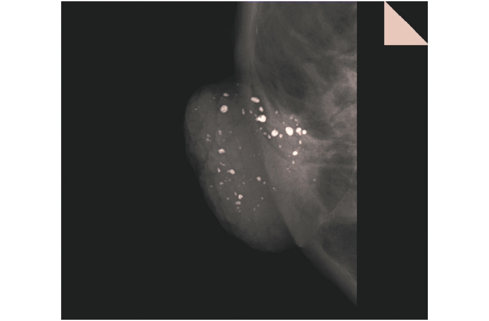 【2018 红点奖】MAMMOMAT Revelation / 乳房X射线摄影系统 - 普象网