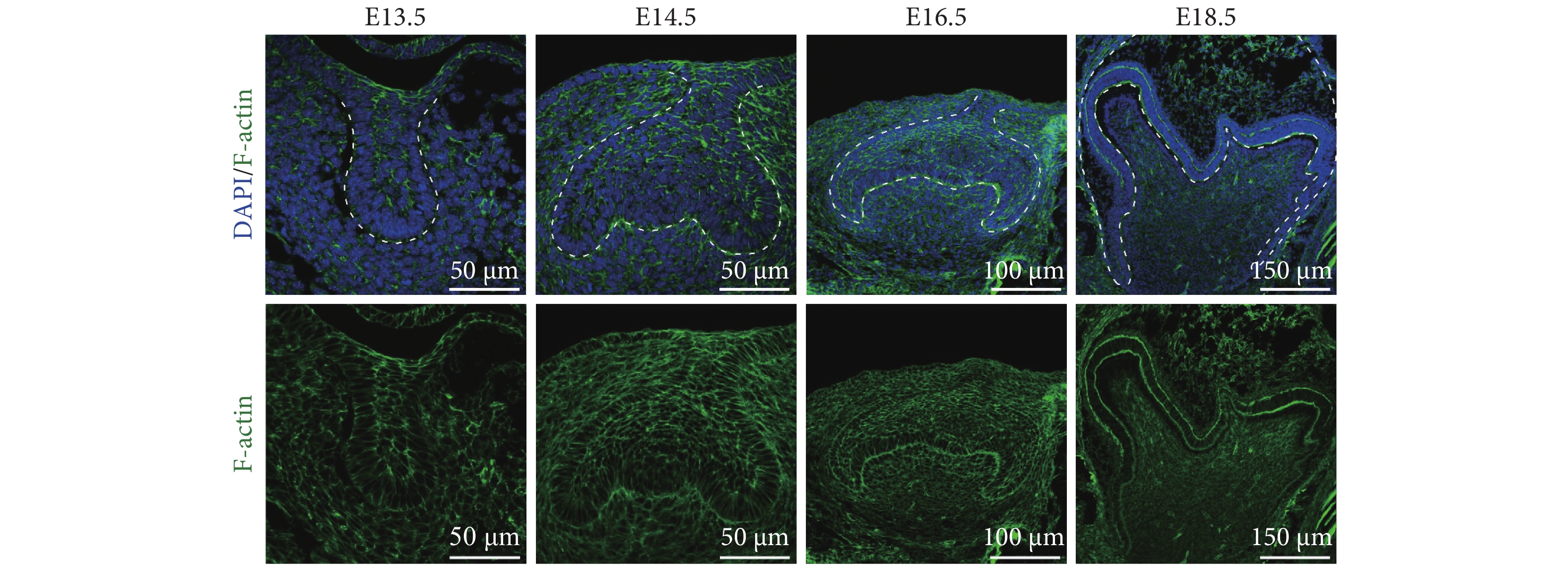 f-actin在小鼠磨牙发育过程中的表达(免疫荧光染色