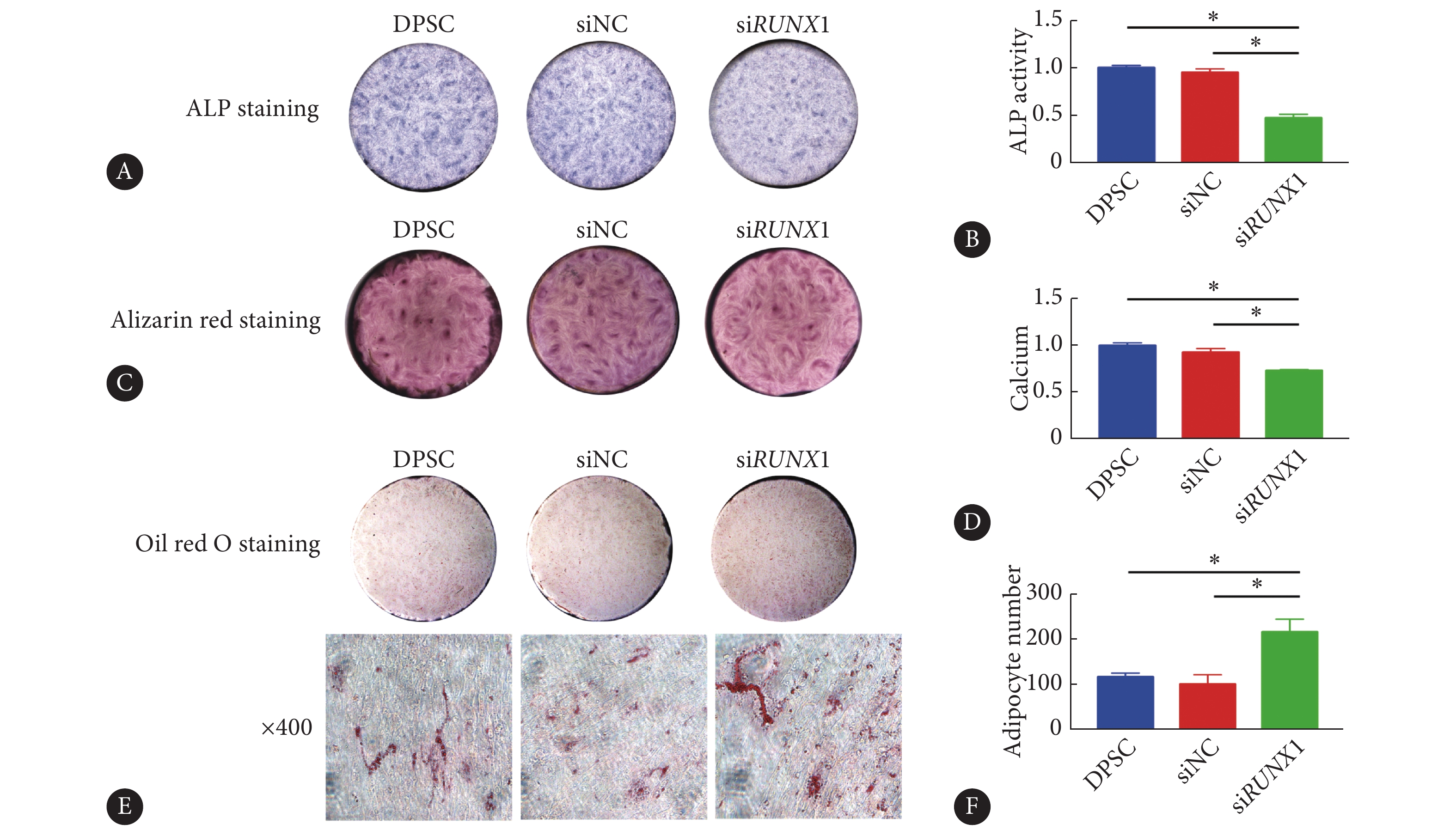 图 runx1在dpsc中敲低后的矿化和成脂表型