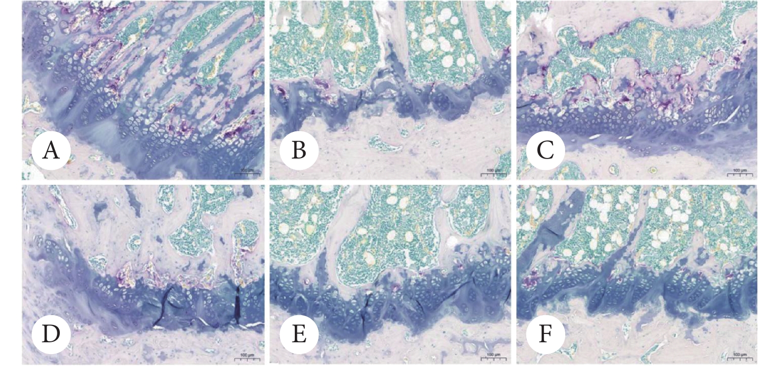 trap染色破骨细胞的代表性切片