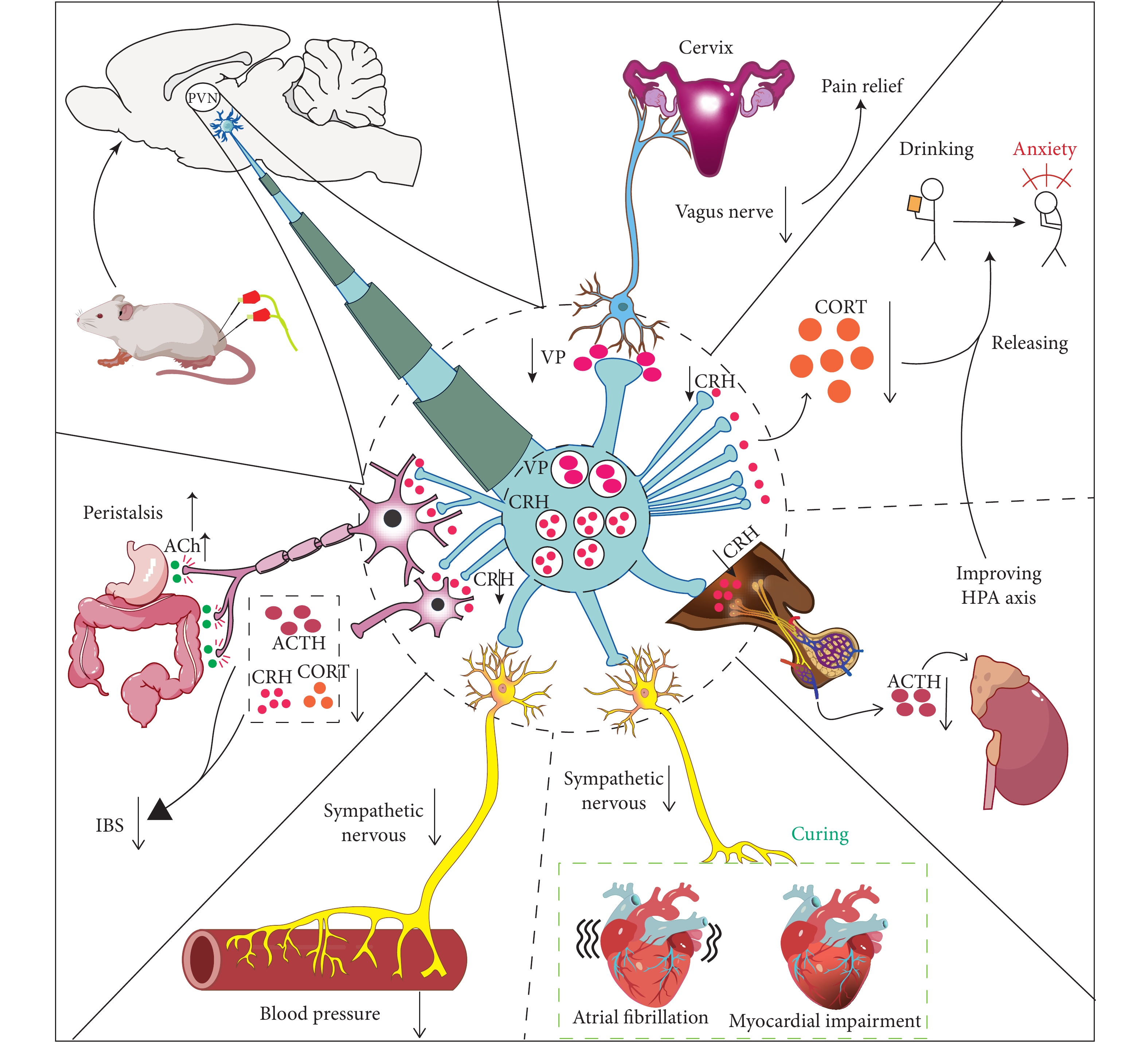 PVN参与针灸治疗疾病机制